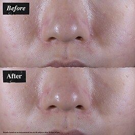 Ultra Facial - Oil Free Gel Cream